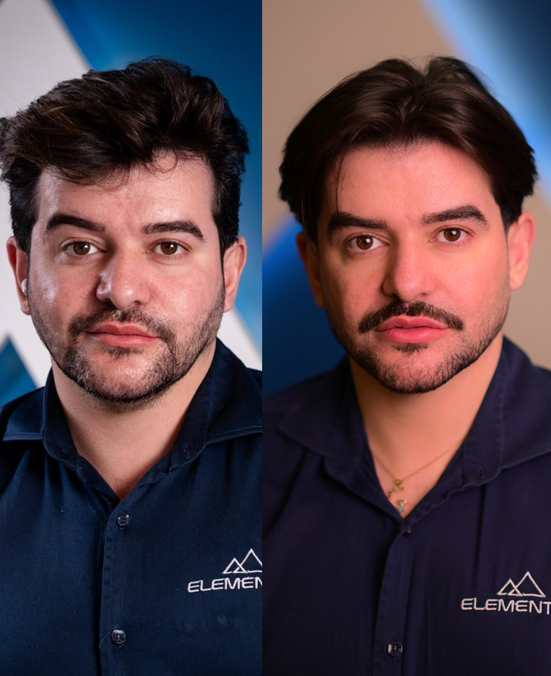 Harmonização facial